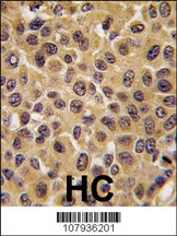 CDC25B Antibody