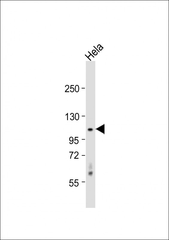 CDKL5 Antibody