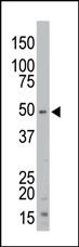 STK35 Antibody