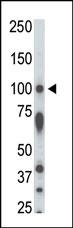 STK31 Antibody