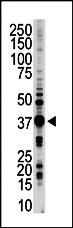 STK16 Antibody
