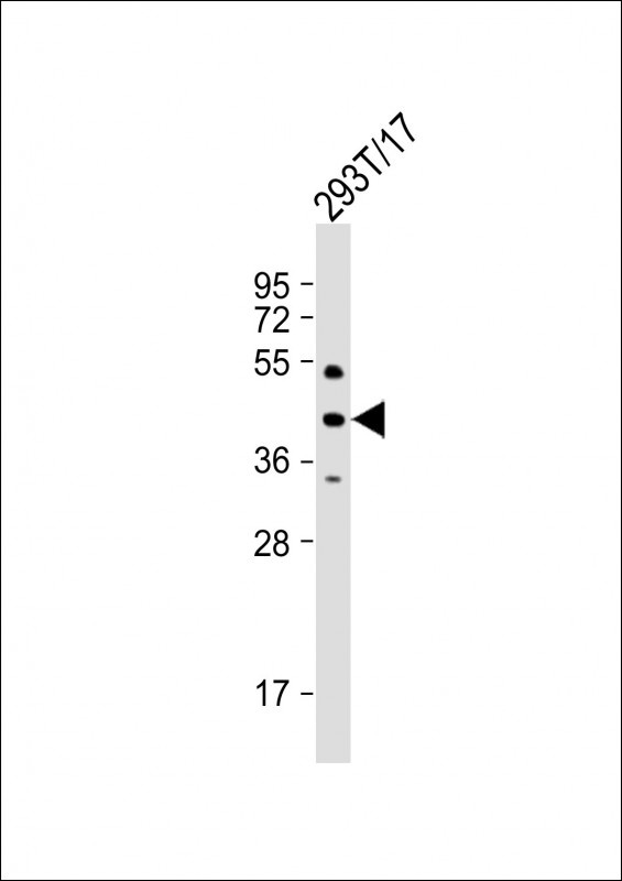 PHKG2 Antibody