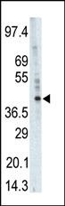 PHKG1 Antibody