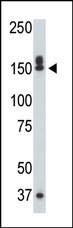 DAPK1 Antibody