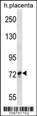 SCYL1 Antibody