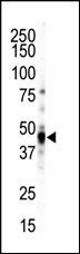 CAMK1D Antibody