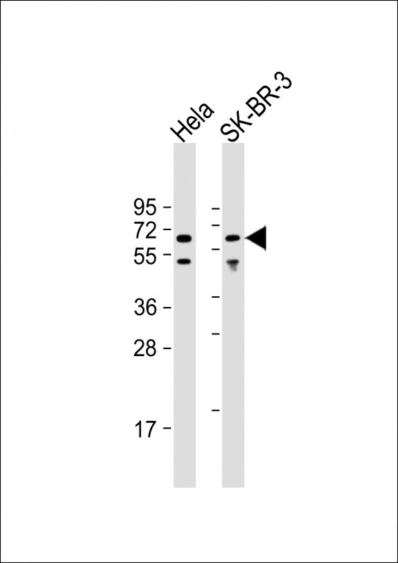 PRKAA1 Antibody