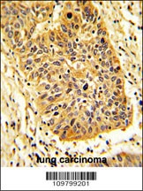 RIOK1 Antibody