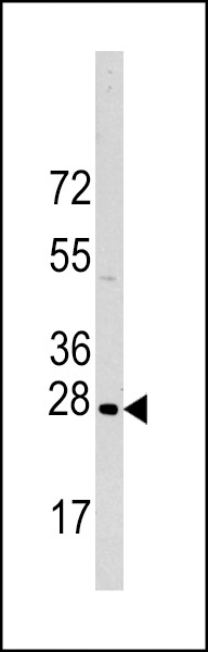HSPB1 Antibody
