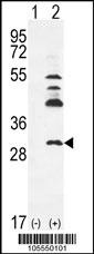 UCK2 Antibody