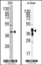 AKR7A2 Antibody