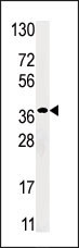 RBKS Antibody