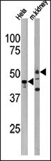 PSKH1 Antibody