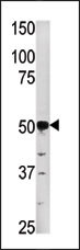 PGK2 Antibody