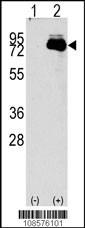 NUAK2 Antibody