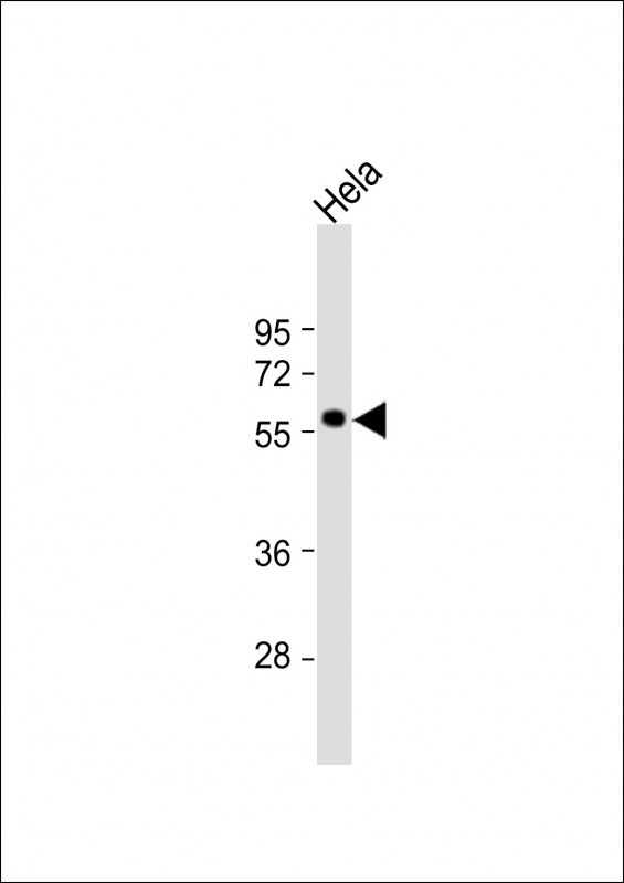 MKNK2 Antibody