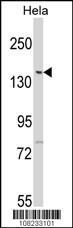 LMTK2 Antibody