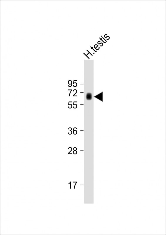 HIPK4 Antibody