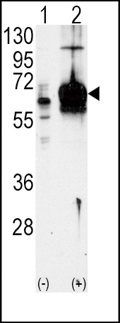 Guanylyl Cyclase alpha 1 Antibody