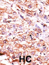 Guanylyl Cyclase alpha 2 Antibody