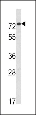 AMHR2 Antibody