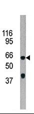 ADCK5 Antibody