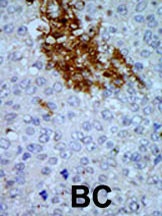 PNCK Antibody