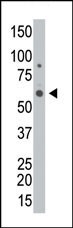 GALK2 Antibody