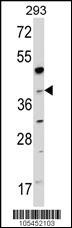 NAGK Antibody