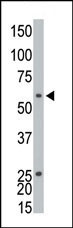 ETNK1 Antibody