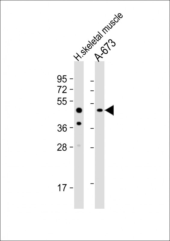 UHMK1 Antibody