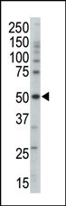 PRKAG3 Antibody