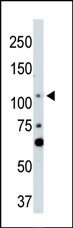 LATS2 Antibody