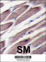 LATS2 Antibody