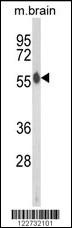 AKT2 Antibody