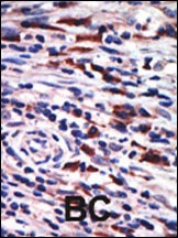 PKC eta Antibody