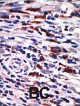 PRKCH Antibody