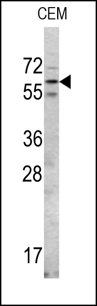 RIOK2 Antibody
