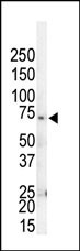 GRK4 Antibody