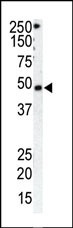 GRK1 Antibody