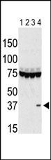 AURKC Antibody