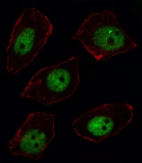 SORBS2 Antibody