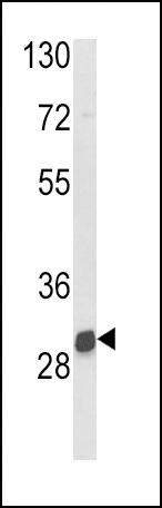 NAT2 Antibody