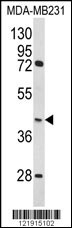HOMER3 Antibody