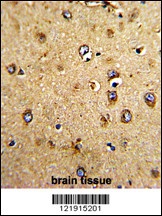 HOMER3 Antibody