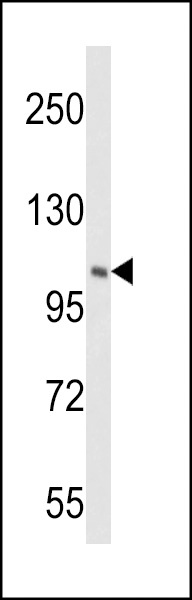 PI4KB Antibody