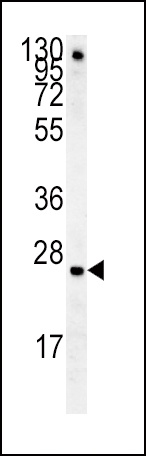 IGFBP4 Antibody