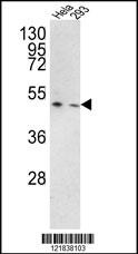 TMPRSS3 Antibody