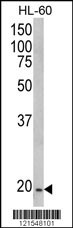 NDUFS4 Antibody