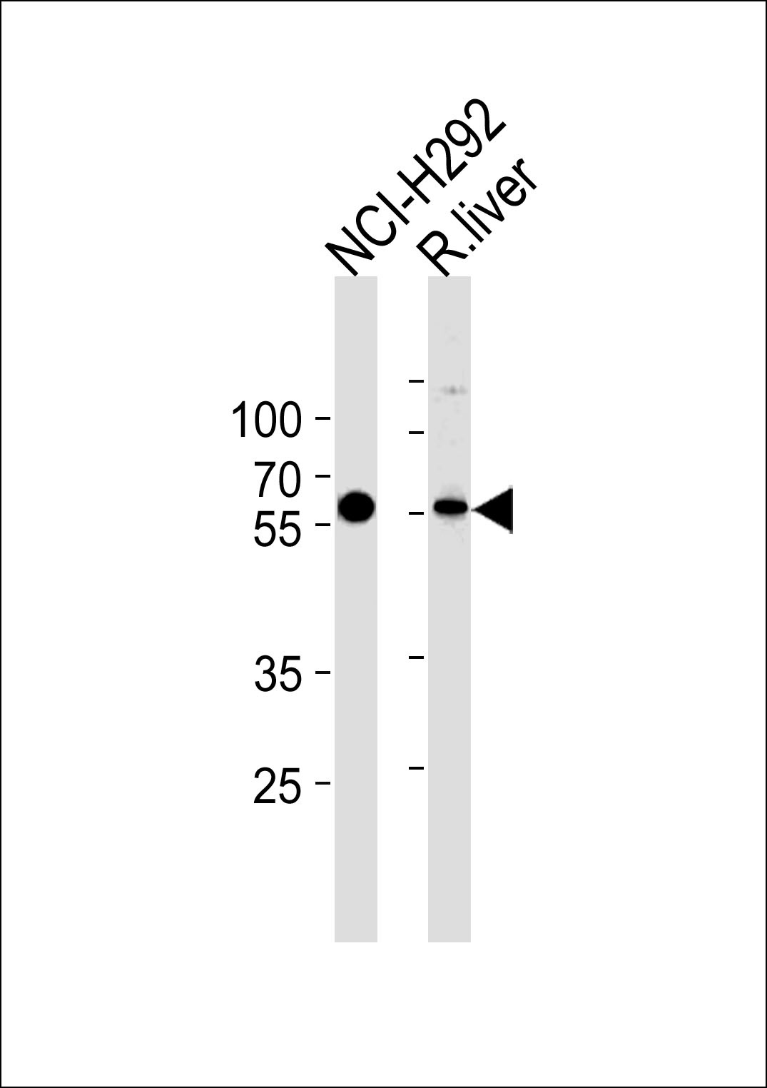 MCCC2 Antibody